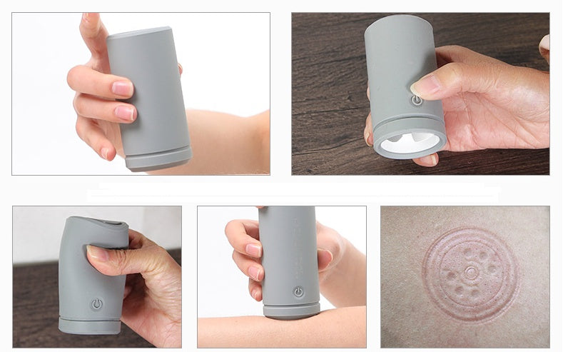 Luxury Electric Silicone Cupping Therapy Massager — EMS Pulse Full Body Massage & Vacuum Suction Wellness Device