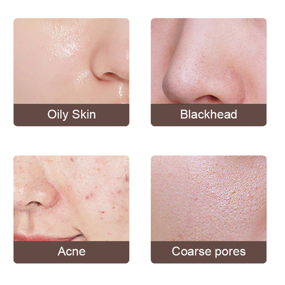 Ultrasonic Skin Scrubber & Face Spatula | 4-in-1 EMS Ionic Deep Pore Cleansing Beauty Device